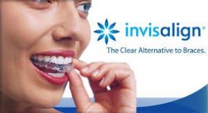 Invisalign and MTM Services - Vernon Dental Associates